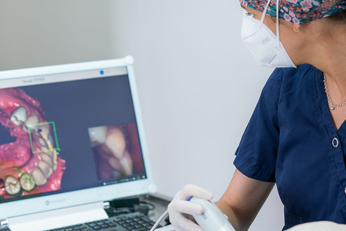 PARODONTIE lyon dentiste