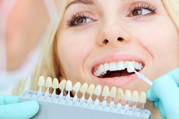 ESTHETIQUE DU SOURIRE lyon
