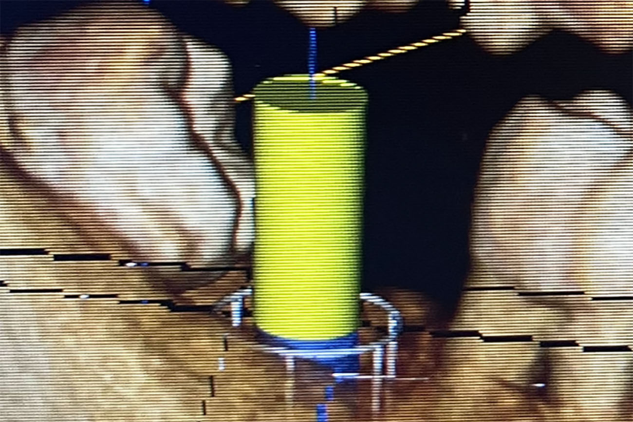 implant dent sagesse