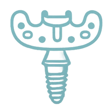 implants lyon chirurgie guidée