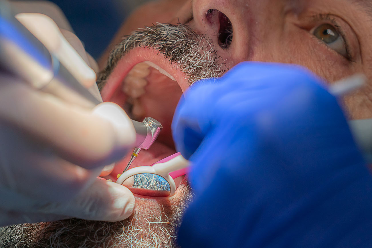 détartrage lyon dentiste Labelia